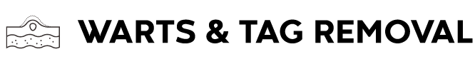 Warts & Tag Removal